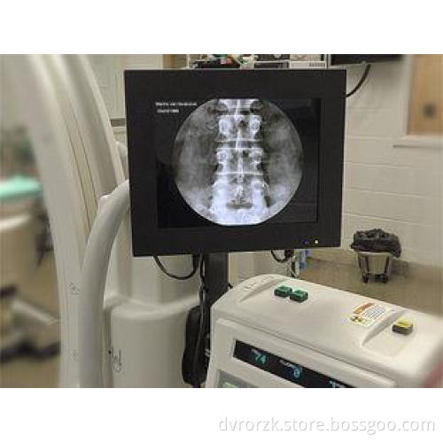 Color TFT Black Medical Lcd Monitor With 3D Digital Noise R